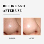 Tea Tree Blackhead Mask Manufacturer - Natural Peel-Off Nose Strips