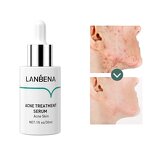 LANBENA Oligopeptide Anti-Acne Serum - Pimple Treatment & Acne Mark Reduction