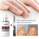 LANBENA Anti Fungal Nail Treatment Serum Manufacturer - Nail Care Repair Essence 15ml