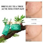 Tea Tree Oil Serum Manufacturer - Acne Solution Face Cream Kit