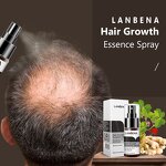 Hair Grow Spray Manufacturer - Herbal Treatment for Women