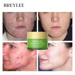 Private Label Tea Tree Scar Repair Cream Manufacturer - Pimple Removal Face Cream