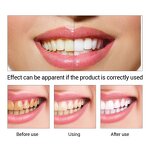 LANBENA Dental Powder Manufacturer - Teeth Whitening Oral Hygiene Cleaning Powder