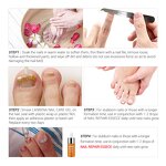 LANBENA Manufacturer Nail Fungus Treatment & Repair Gel - Private Label