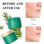 Tea Tree Oil Cleansing Pad Manufacturer - Salicylic Acid for Pore Minimizing & Cutin Removal