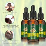 Organic Vegan Ginger Hair Growth Serum Manufacturer - Herbal Anti-Hair Loss Oil for Women & Men