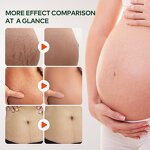 Postpartum Belly Oil Manufacturer - Organic Scar Healing & Skin Moisturizing Essential Oil