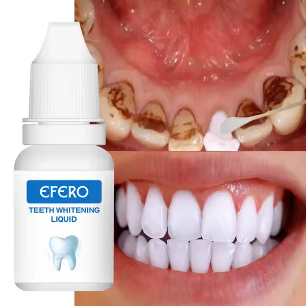 Teeth Whitening Essence Manufacturer - 10ml for Home Use & Plaque Stains