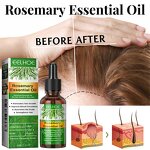Rosemary Essential Oil Manufacturer - Organic Hair Growth Stimulating & Scalp Nourishing Treatment