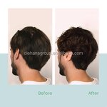 Custom Organic Vegan Rosemary Shampoo Manufacturer - Anti-Dandruff, Moisturizing & Scalp Care for Daily Use