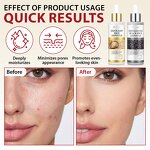 Korean Skin Care Serum Manufacturer - 100ml Peel Shot Glow Moisturizing Hydrating Exfoliating Ampoule for All Skin Types