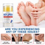 Urea Cream Stick Manufacturer - 60% Urea for Exfoliating Dry Cracked Skin on Feet Hands Knees