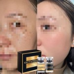 Glutathione Powder Manufacturer - Private Label Lyophilized Kit