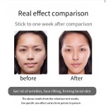 Anti-Wrinkle Machine Manufacturer - USB Home Use Firming Massager