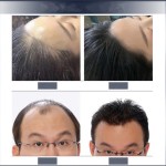 防脱解决方案供应商- ZS EGF抗衰老毛囊修复