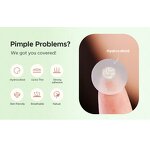 Hydrocolloid Acne Patch Manufacturer - Clear Healing Pimple Spot Treatment for Private Label