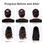 Biotin Shampoo Manufacturer - Custom Logo Hair Growth Formula with Castor Oil & Onion DHT Blocker