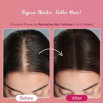 Hair Growth Foam Manufacturer - Private Label Biotin & Castor Oil Treatment for Women