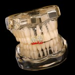 Teeth Grillz Supplier - Full Diamond Copper Zircon Dental Grillz