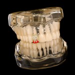 Teeth Grillz Supplier - Full Diamond Copper Zircon Dental Grillz