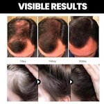 Rosemary Essential Oil Manufacturer - Organic Hair Growth Treatment for Strengthening & Shine