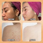 Turmeric Soap Manufacturer - Private Label Organic 100g Handmade with Kojic Acid for Skin Brightening