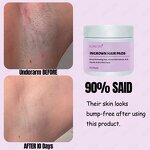 Ingrown Hair Pads Manufacturer - Custom Logo, Safe for Sensitive Skin