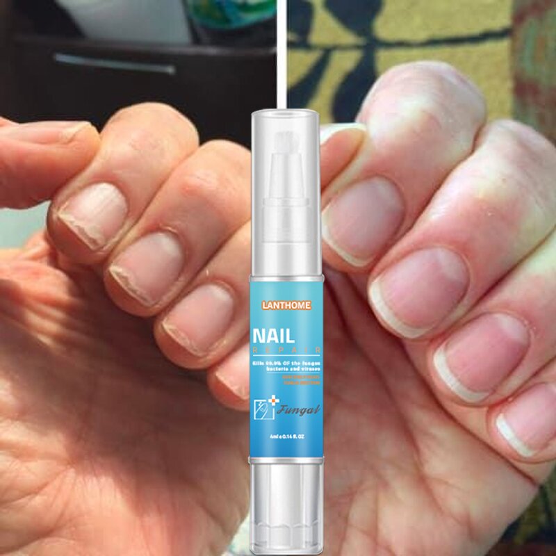 Lanthome Herbal Nail Repair Treatment Pen - 4ml Anti-Fungal Toenail Care Tool