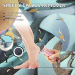 Electric Callus Remover Manufacturer - Portable with 60 Metal Sandpaper Discs