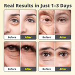 Eye Cream Manufacturer - Private Label Anti-Aging with Vitamin E & Hyaluronic Acid