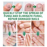 Nail Fungus Cream Manufacturer - Plant Extract Formula for Repair & Hydration