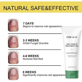 Nail Fungus Cream Manufacturer - Plant Extract Formula for Repair & Hydration