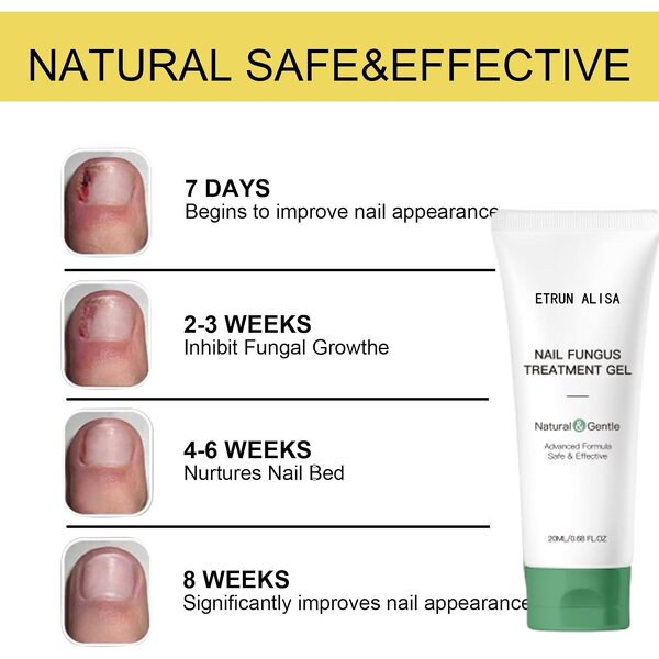 Nail Fungus Cream Manufacturer - Plant Extract Formula for Repair & Hydration