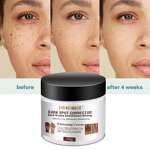 Whitening Cream Manufacturer - Dark Spot Corrector for Face & Body