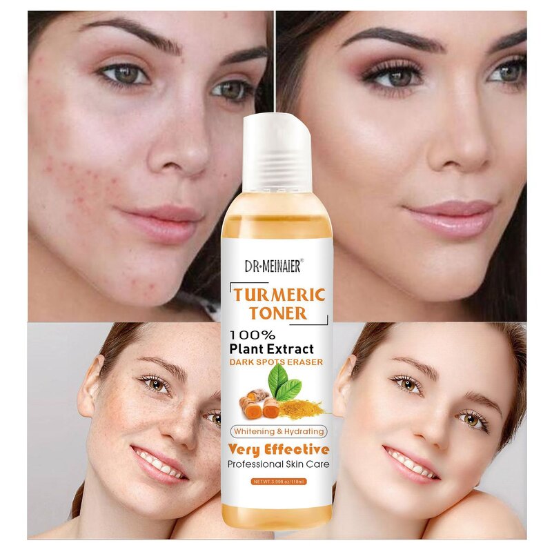 Turmeric Water Toner Manufacturer - Whitening Anti-Acne Skincare Corrector
