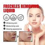 Face Serum Manufacturer - Private Label Collagen Vitamin C for Freckle Removal & Skin Brightening