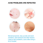 Pimple Patch Manufacturer - Private Label Hydrocolloid Customized Colorful Stars