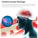 Photobiological Regulation PBM Helmet Manufacturer - 810nm LED 15W for Brain Pain Therapy