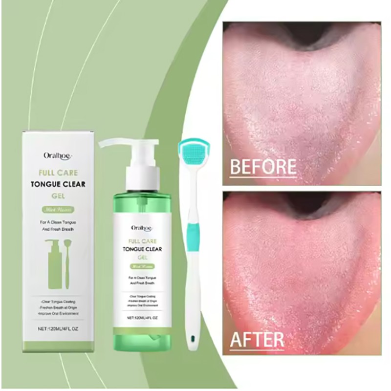 Tongue Gel Manufacturer - Private Label Oral Hygiene Gel