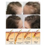 Hair Growth Serum Manufacturer - Private Label Ginger Hair Oil