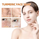 Whitening Soap Supplier - Custom Turmeric Facial Soap