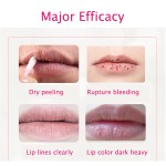 Lip Sleeping Mask Factory - Private Label 24K Gold Lip Mask