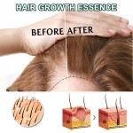 Hair Growth Spray Factory - OEM Ginseng Hair Growth Serum