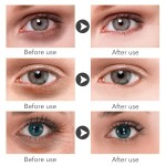 Eye Cream Supplier - Custom Under Eye Bags Removal Cream