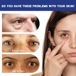 Eye Cream Supplier - ODM Tea Tree Eye Repair Cream