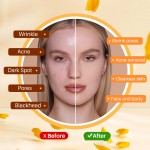 Ginger Soap Manufacturer - Private Label Turmeric Bar Soap