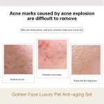 Skin Care Set Supplier - Private Label Hyaluronic Acid Set