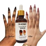 Whitening Serum Factory - OEM Dark Knuckle Whitening Serum
