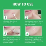 Acne Patch Manufacturer - Private Label Hydrocolloid Pimple Patch