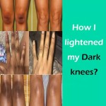 Whitening Serum Factory - OEM Dark Knuckle Whitening Serum